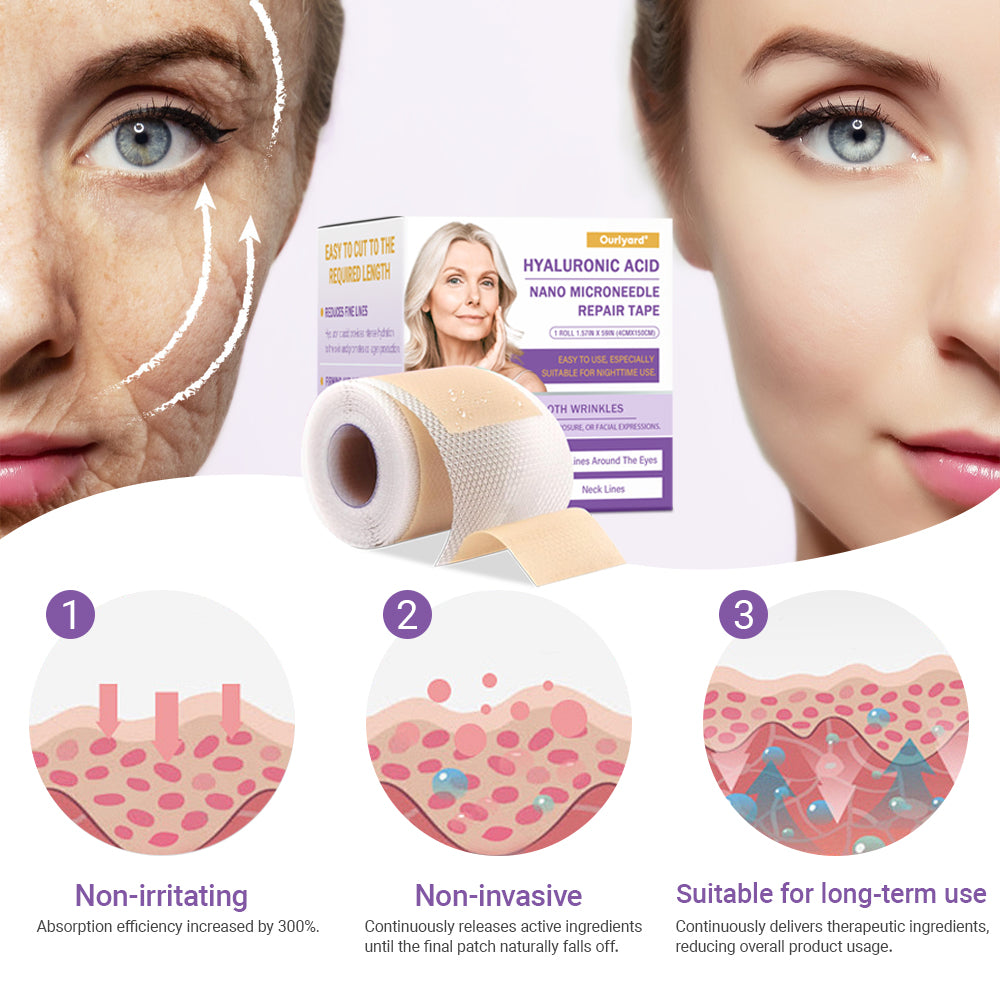 ✅Official Store | Ourlyard® Hyaluronic Acid Nano Microneedle Repair Tape 🦘❤️(Repairs wrinkles, fine lines, skin laxity, etc., suitable for multiple areas such as the face, hands, abdomen, legs – 1.6 inch x 59 inch roll)