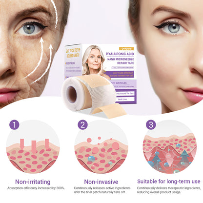 ✅Official Store | Ourlyard® Hyaluronic Acid Nano Microneedle Repair Tape 🦘❤️(Repairs wrinkles, fine lines, skin laxity, etc., suitable for multiple areas such as the face, hands, abdomen, legs – 1.6 inch x 59 inch roll)