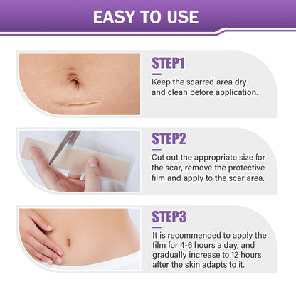 ✅ FDA Approved | Ourlyard® Hyaluronic Acid Nano Microneedle Repair Tape🗽✨(Effective in fading various types of scars, including surgical scars, burn scars, acne scars, and stretch marks, while improving uneven skin tone and skin imperfections.)
