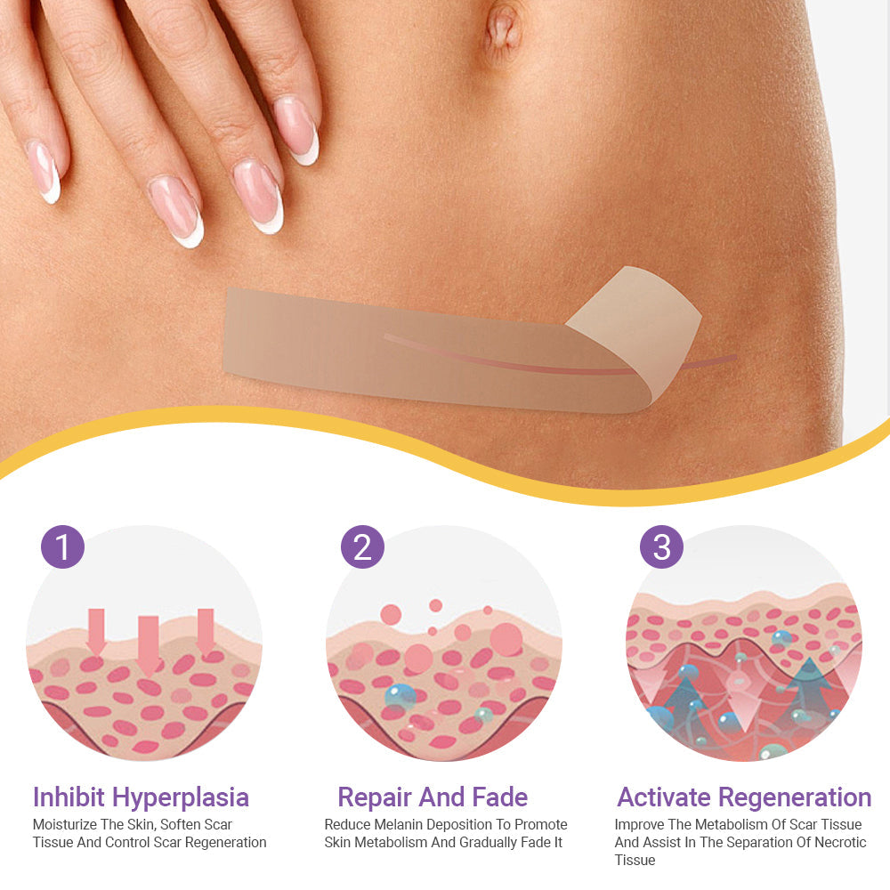 ✅ FDA Approved | Ourlyard® Hyaluronic Acid Nano Microneedle Repair Tape🗽✨(Effective in fading various types of scars, including surgical scars, burn scars, acne scars, and stretch marks, while improving uneven skin tone and skin imperfections.)