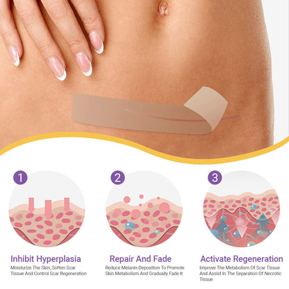 ✅ FDA Approved | Ourlyard® Hyaluronic Acid Nano Microneedle Repair Tape🗽✨(Effective in fading various types of scars, including surgical scars, burn scars, acne scars, and stretch marks, while improving uneven skin tone and skin imperfections.)