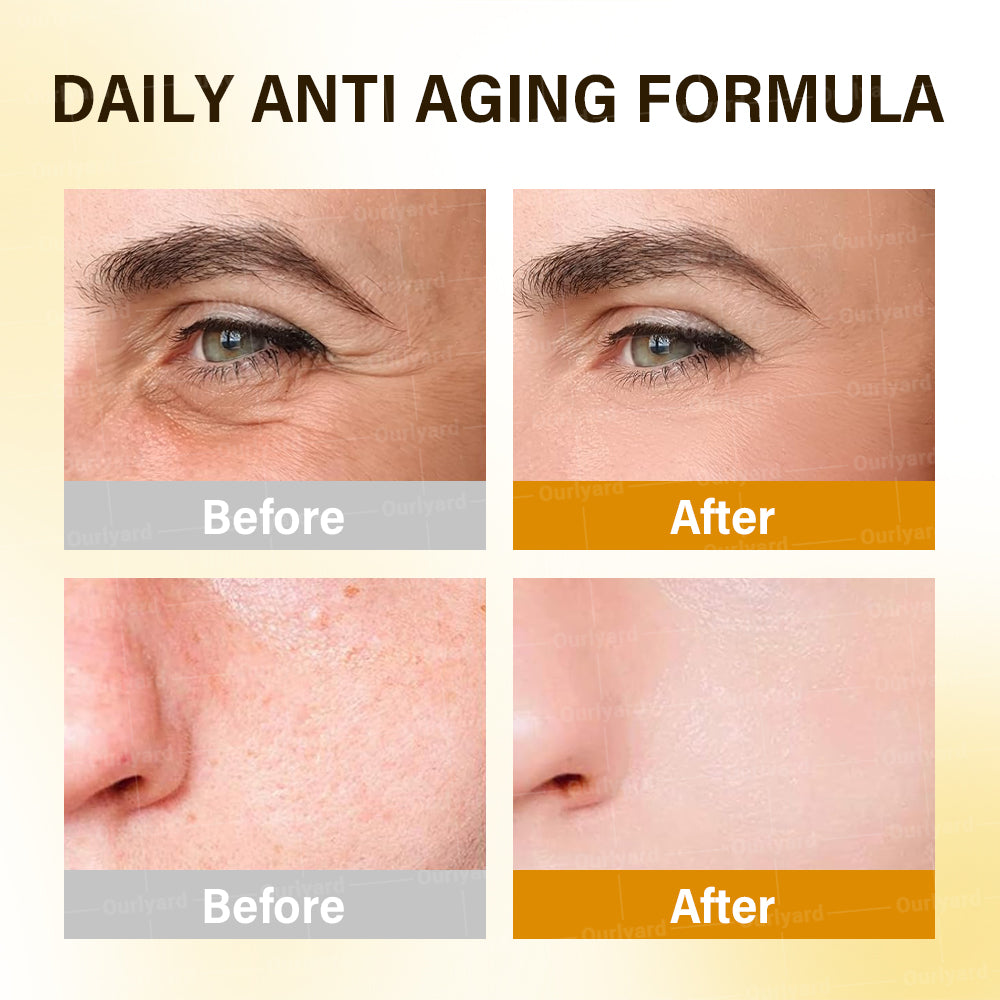 ✅Official Store |🗽👨‍⚕️Rolimey® Anti-Aging Moisturizing Cream with Hyaluronic Acid, Retinol & Collagen – For Face, Neck, Décolleté & Legs – Made in United States – Day & Night Use