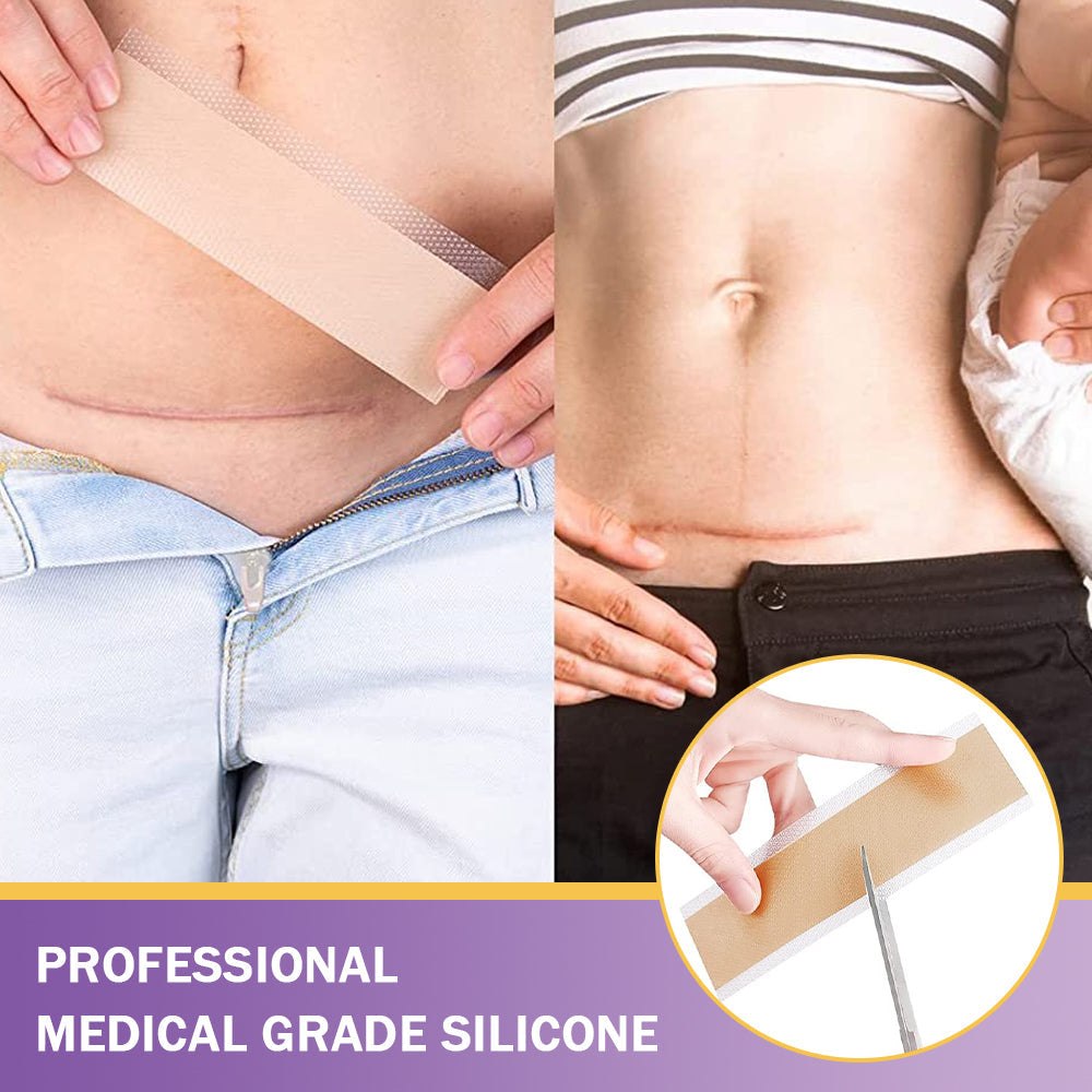 ✅ FDA Approved | Ourlyard® Hyaluronic Acid Nano Microneedle Repair Tape🗽✨(Effective in fading various types of scars, including surgical scars, burn scars, acne scars, and stretch marks, while improving uneven skin tone and skin imperfections.)